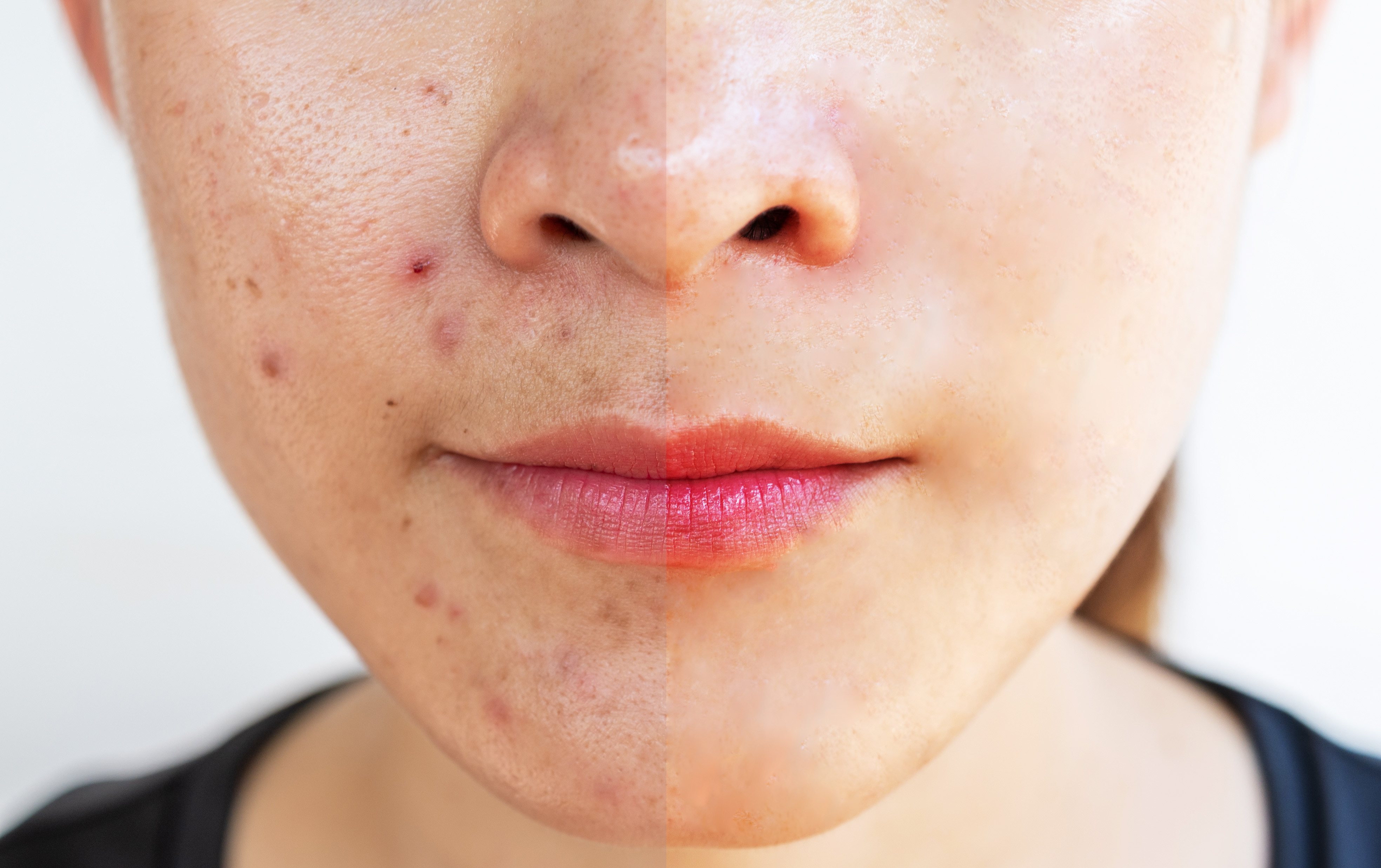 肌リタッチの画像